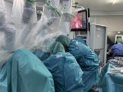 Noves solucions amb cirurgia robòtica per a l’endometriosi profunda